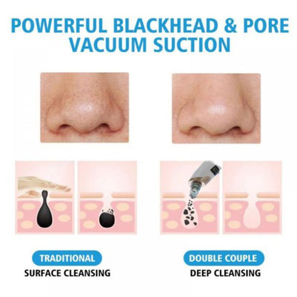 Electric Blackhead Remover Pore Cleaning Suction